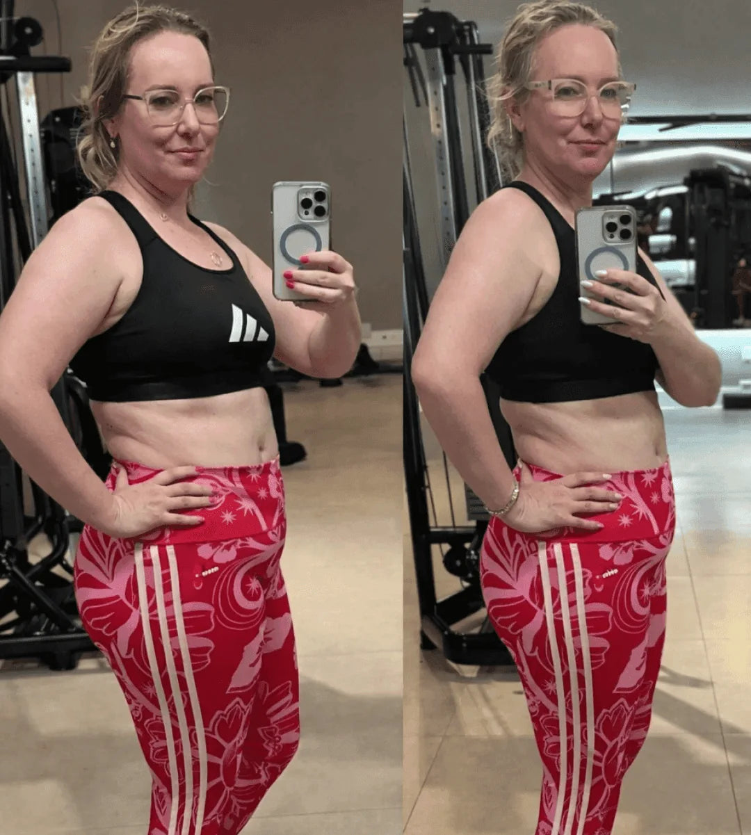 Viviane Rizzolo antes e depois do tratamento