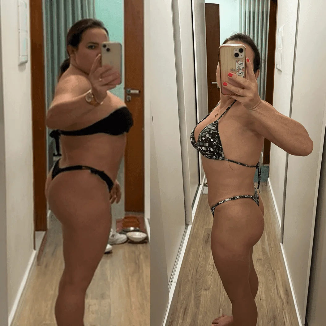 Tatiane Marabita antes e depois do tratamento